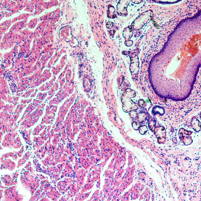 分层的鳞状上皮