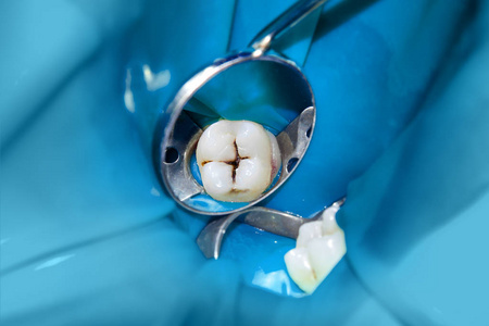 photopolymeric图片-photopolymeric素材-photopolymeric插画-摄图新