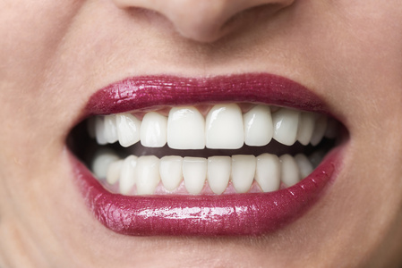 女性满口洁白的牙齿照片