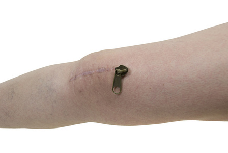 伤疤拉链头上的伤疤照片