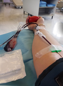 献血者在医院进行，需要输液过程