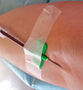 献血者在输血和捐赠