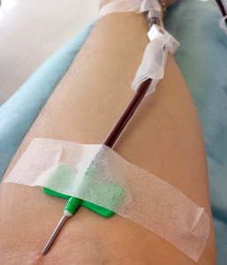 在献血过程中针入血献血者的手臂