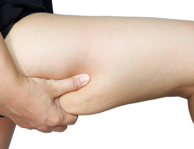 女性腿大腿与脂肪团隔离在白色背景.