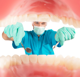 牙医照顾的牙菌斑图片