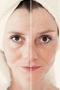 美概念-护肤, 抗衰老程序, 复兴照片