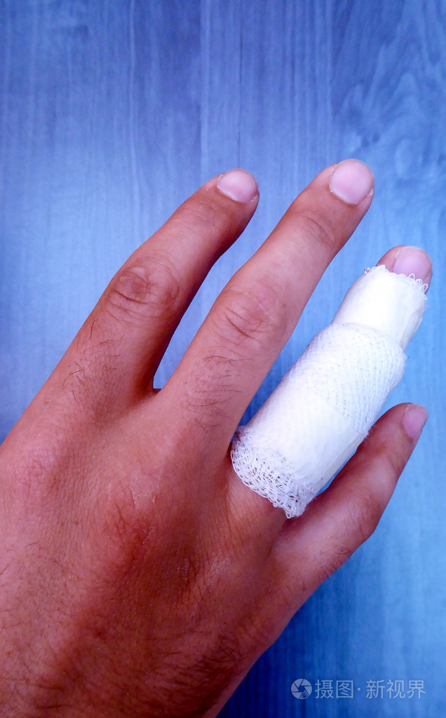 受伤痛苦男手手指照片-正版商用图片0bgnqx-摄图新视界