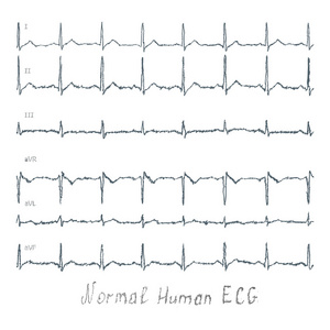 正常心电图人类图