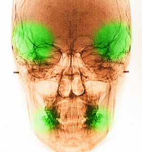 薄膜 x 射线扫描人类