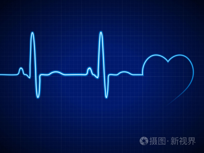 心脏节律心电图
