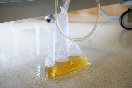 塑料尿收集袋挂在病人的床下照片