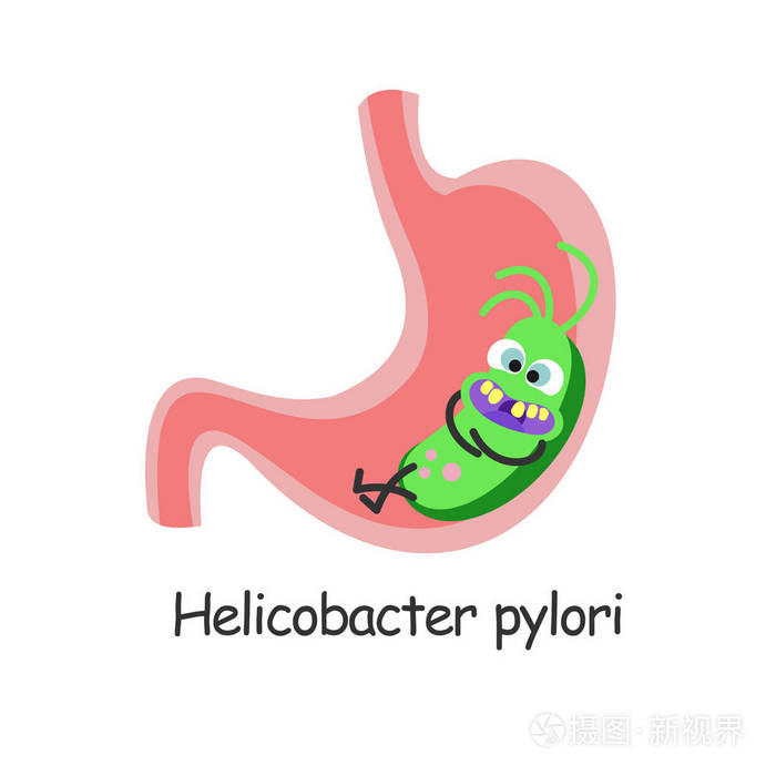 幽门螺杆菌坐在胃里的有害细菌矢量图