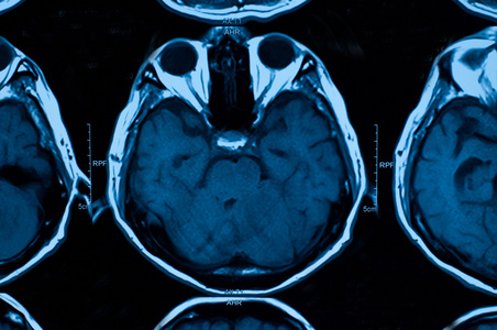 在医学的研究。Ct 扫描的病人