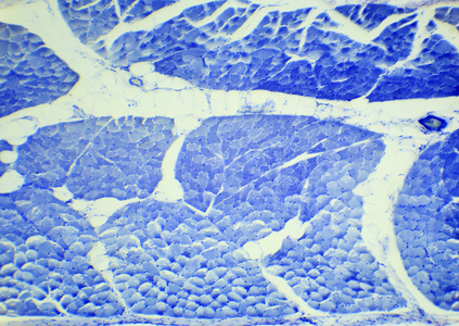 细胞质基质平滑肌嘲笑在显微镜下,制备光滑医科大学照片