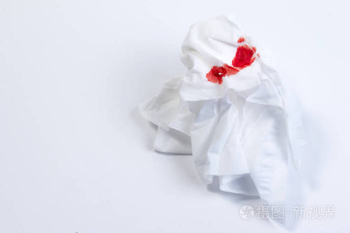 伤血,血在白色背景上的纸巾上.流鼻血或鼻出血治疗血液在生活用纸.