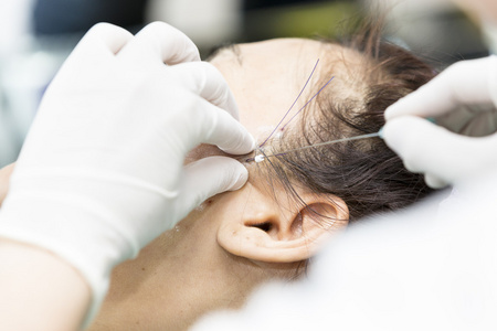 圆针手术缝合针图片-圆针手术缝合针素材-圆针手术缝合针插画-摄图新