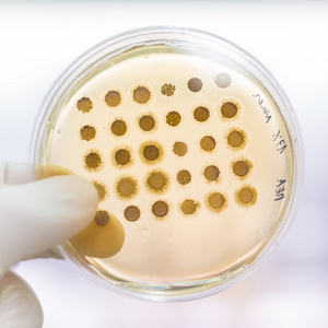 sikri印度,阿格拉:泰姬陵琼脂平板上生长的真菌白色分离的桔蝇琼脂