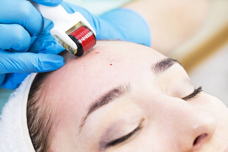 女人经历医用微针疗法与现代医学仪器真皮滚子的过程照片