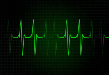 心跳频率图片