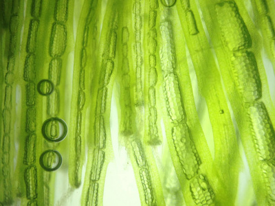 变焦微生物藻类细胞图片
