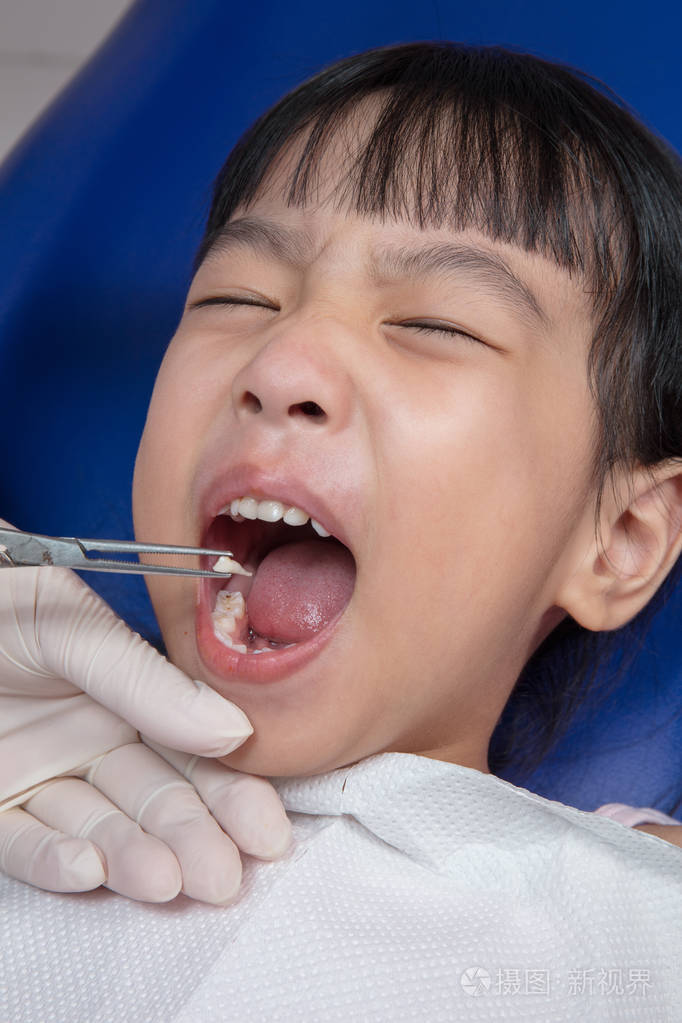 亚洲中国小姑娘躺拔牙照片-正版商用图片0colpr-摄图新视界