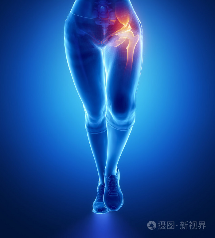 在女性体内的臀部疼痛