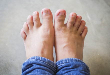 短脚短脚趾照片