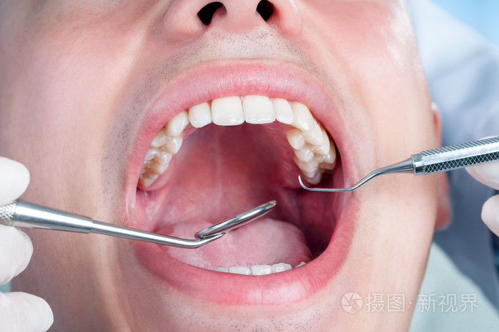 人类男性牙齿排列显示