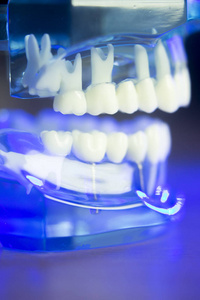 牙科牙齿临床模型