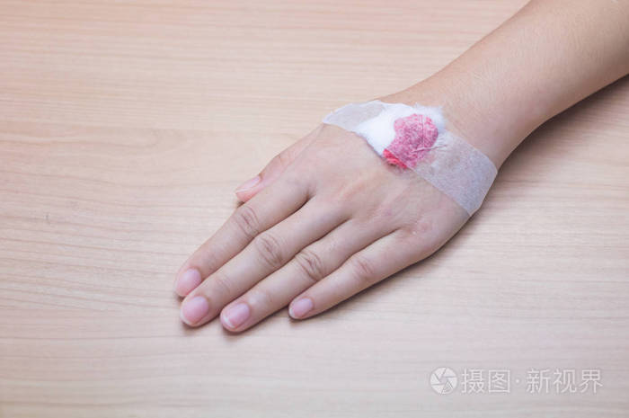 受伤的手,用血淋淋的绷带