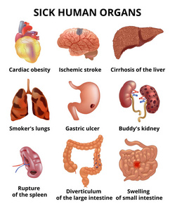 现实的病人体器官设置文本与解剖