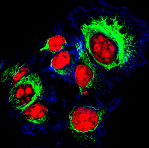用荧光分子标记的卵巢癌细胞