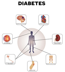 糖尿病并发症信息图形
