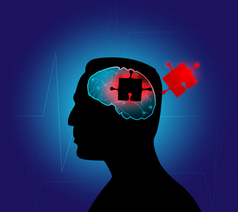 人类的大脑照片