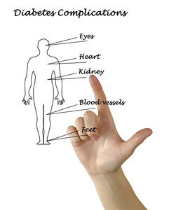 糖尿病并发症