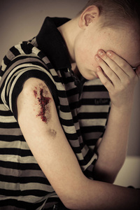 受伤了出血图片