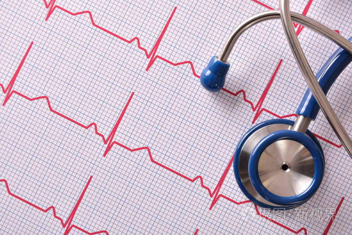 听诊器对心电图顶视图