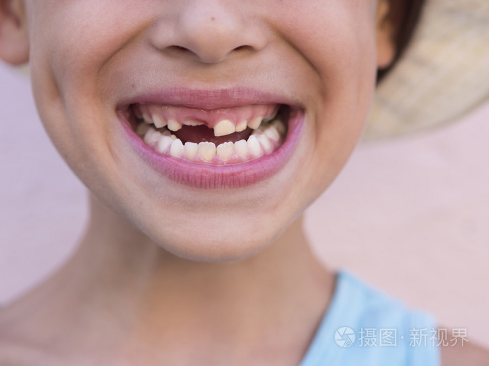 孩子的牙齿微笑