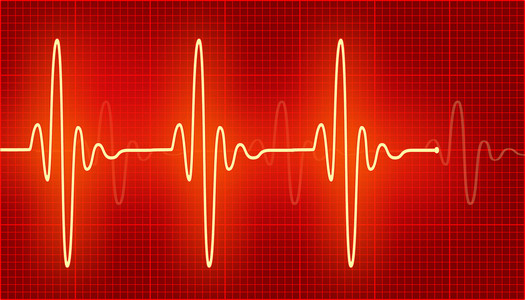 怎么制作心电波图片