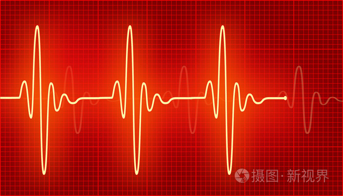 明亮的心电图波照片-正版商用图片0e51br-摄图新视界
