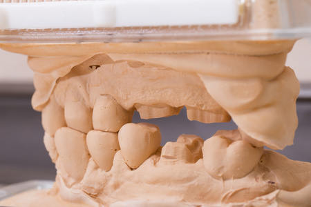 牙的石膏牙科石膏模型模具