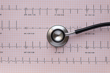 Stethscope 上的心电图或心电图有用的医学单词医学 w