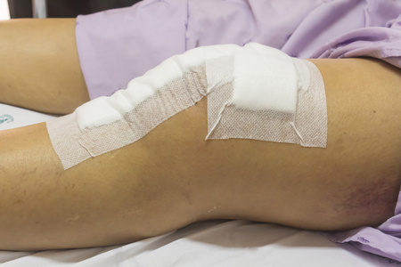 分离卡通侦探用绷带上脸矢量图孩子受伤了. 用绷带在孩子的膝盖上.