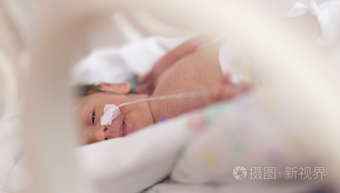 早产新生儿女婴
