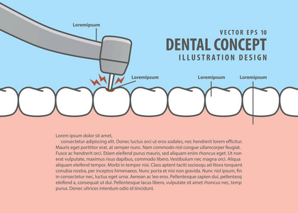 版面衰减牙齿治疗 龋 卡通风格的信息或