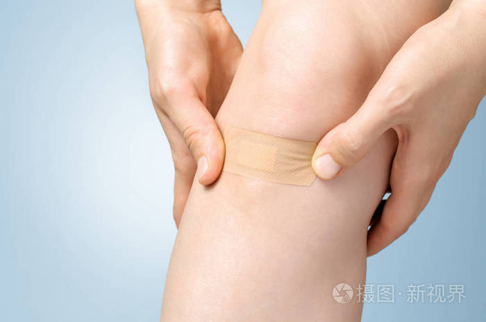 在女性的腿上石膏