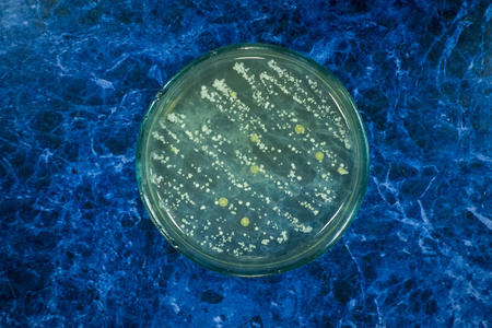 细菌培养皿图片
