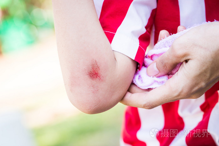 年轻的孩子与出血的手臂伤口附近弯头