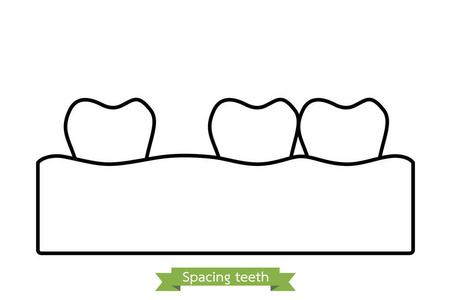 间距牙齿 纵裂卡通矢量轮廓样式