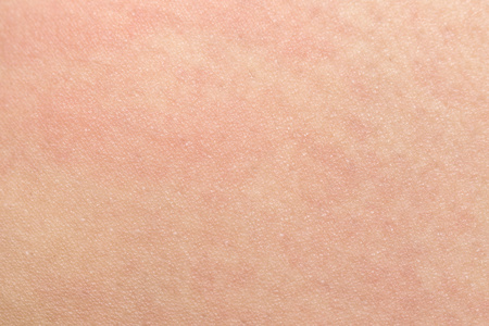 人体皮肤的质地,为的回来的皮肤上,黑色的头发照片